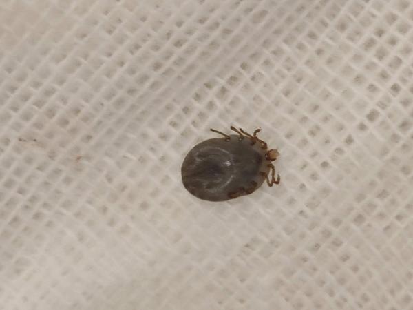 急诊取出的蜱虫